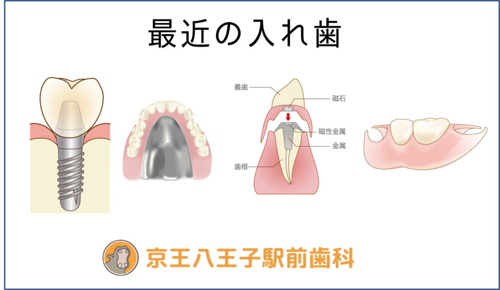 最近の入れ歯