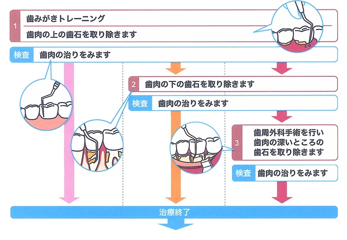 歯周病治療・手術