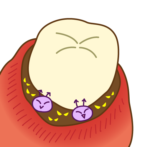 歯石には細菌がいっぱい